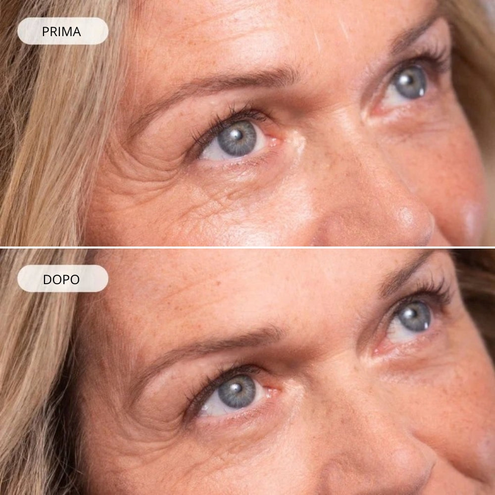 Trattamento Occhi Anti-age Effetto Filler